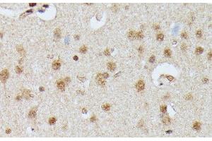 Immunohistochemistry of paraffin-embedded Rat brain using IGHMBP2 Polyclonal Antibody at dilution of 1:100 (40x lens). (IGHMBP2 Antikörper)