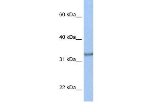 Western Blotting (WB) image for anti-Acyl-CoA Binding Domain Containing 4 (ACBD4) antibody (ABIN2459338) (ACBD4 Antikörper)