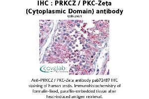 Image no. 2 for anti-Protein Kinase C, zeta (PRKCZ) (1st Cytoplasmic Domain) antibody (ABIN1738343) (PKC zeta Antikörper  (1st Cytoplasmic Domain))