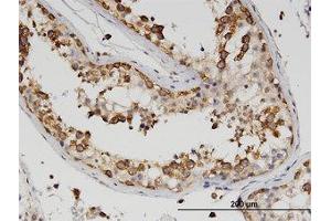 Image no. 2 for anti-Z-DNA Binding Protein 1 (ZBP1) (AA 2-101) antibody (ABIN599594) (ZBP1 Antikörper  (AA 2-101))