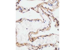 B staining TUBA4A in human lung tissue sections by Immunohistochemistry (IHC-P - paraformaldehyde-fixed, paraffin-embedded sections). (TUBA4A Antikörper  (C-Term))