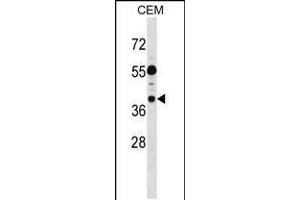 Western blot analysis in CEM cell line lysates (35ug/lane). (TSSC1 Antikörper  (C-Term))