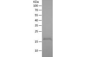 Western Blotting (WB) image for WAP Four-Disulfide Core Domain 3 (WFDC3) (AA 25-160) protein (His tag) (ABIN7282819) (WFDC3 Protein (AA 25-160) (His tag))