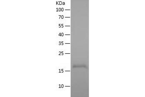 WFDC3 Protein (AA 25-160) (His tag)