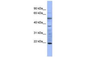 Image no. 1 for anti-Myosin, Light Chain 3 (MYL3) (AA 35-84) antibody (ABIN6741643) (MYL3/CMLC1 Antikörper  (AA 35-84))