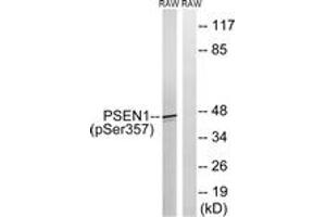 Western blot analysis of extracts from RAW264. (Presenilin 1 Antikörper  (pSer357))