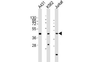 All lanes : Anti-RBMX Antibody (Center) at 1:2000 dilution Lane 1: A431 whole cell lysates Lane 2: K562 whole cell lysates Lane 3: Jurkat whole cell lysates Lysates/proteins at 20 μg per lane. (RBMX Antikörper  (AA 222-252))