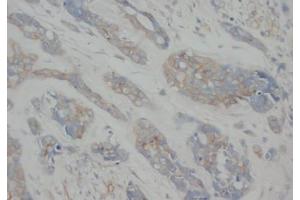 Immunohistochemistry (IHC) image for anti-Tubulin, alpha 1a (Tuba1a) antibody (ABIN1105303)