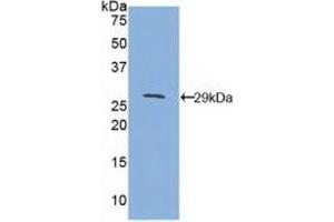 Western blot analysis of recombinant Mouse CD1d. (CD1d Antikörper  (AA 56-271))