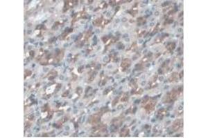 IHC-P analysis of Rat Stomach Tissue, with DAB staining. (ORM1 Antikörper  (AA 20-186))