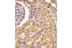 (ABIN390810 and ABIN2841047) staining ASS in human kidney tissue sections by Immunohistochemistry (IHC-P - paraformaldehyde-fixed, paraffin-embedded sections). (ASS1 Antikörper  (AA 192-221))