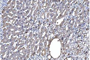 IHC analysis of GFPT1 using anti-GFPT1 antibody (ABIN7602887). (GFPT1 Antikörper  (C-Term))