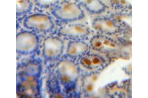 Used in DAB staining on fromalin fixed paraffin-embedded bowels tissue (KRT20 Antikörper  (AA 2-431))