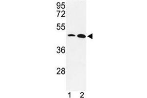 Western blot analysis of KLF4 antibody and MDA-MB231, NCI-H460 lysate. (KLF4 Antikörper  (AA 481-504))