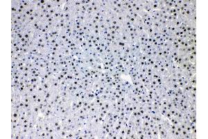 Immunohistochemistry (IHC) image for anti-Hepatoma-Derived Growth Factor (HDGF) (AA 61-97), (C-Term) antibody (ABIN4886613)