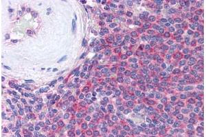 Human Spleen (formalin-fixed, paraffin-embedded) stained with THBS1 antibody ABIN305761 at 5 ug/ml followed by biotinylated anti-mouse IgG secondary antibody ABIN481714, alkaline phosphatase-streptavidin and chromogen. (Thrombospondin 1 Antikörper)