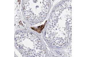 Immunohistochemical staining of human testis with SYNGAP1 polyclonal antibody  shows strong cytoplasmic positivity in Leydig cells. (SYNGAP1 Antikörper)