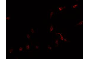 ABIN6269259 staining Hep G2 cells by IF/ICC. (GATA4 Antikörper  (Internal Region))