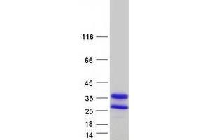 Validation with Western Blot (Deoxyuridine Triphosphatase (DUT) (Transcript Variant 3) protein (Myc-DYKDDDDK Tag))
