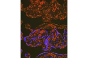 Immunofluorescence analysis of human placenta using PLGF Rabbit mAb (ABIN7269384) at dilution of 1:100 (40x lens). (PLGF Antikörper)
