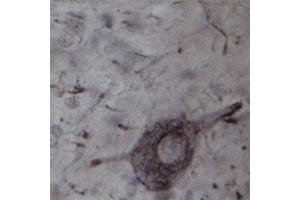 IHC on rat spinal cord (free floating sections) using Rabbit antibody to TRPC4  at a concentration of 20 µg/ml incubated overnight at room temperature with shake, developed with DAB/Ni.
