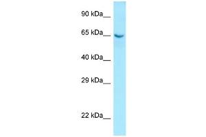WB Suggested Anti-COL9A1 Antibody Titration: 1. (COL9A1 Antikörper  (N-Term))