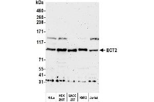 Western Blotting (WB) image for anti-Epithelial Cell Transforming Sequence 2 Oncogene (ECT2) (AA 833-883) antibody (ABIN7453075)