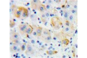 IHC-P analysis of Liver tissue, with DAB staining. (Growth Hormone Receptor Antikörper  (AA 315-574))