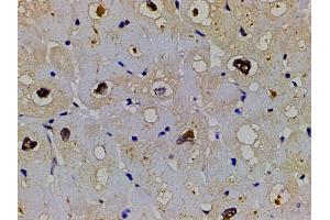 ABIN6267554 at 1/200 staining human heart tissue sections by IHC-P. (LIM Domain Kinase 1 Antikörper  (pThr508))