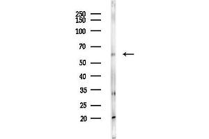anti-Phosphoglucomutase 3 (PGM3) antibody