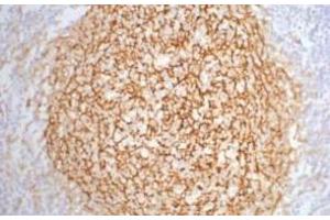 Immunohistochemistry of paraffin-embedded Human tonsil tissue using CD21 Monoclonal Antibody at dilution of 1:200. (CD21 Antikörper)