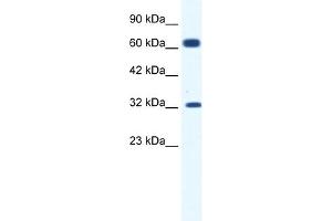 Western Blotting (WB) image for anti-Potassium Intermediate/small Conductance Calcium-Activated Channel, Subfamily N, Member 1 (KCNN1) (C-Term) antibody (ABIN2776145)