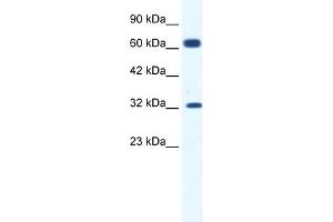 WB Suggested Anti-KCNN1 Antibody Titration:  1. (KCNN1 Antikörper  (C-Term))