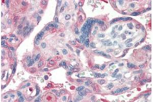 Human Placenta (formalin-fixed, paraffin-embedded) stained with Laminin antibody ABIN364494 at 5 ug/ml followed by biotinylated goat anti-rabbit IgG secondary antibody ABIN481713, alkaline phosphatase-streptavidin and chromogen. (Laminin Antikörper)