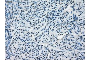 Immunohistochemical staining of paraffin-embedded endometrium tissue using anti-CRYABmouse monoclonal antibody. (CRYAB Antikörper)