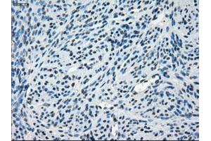 Immunohistochemical staining of paraffin-embedded endometrium tissue using anti-CRYABmouse monoclonal antibody. (CRYAB Antikörper)