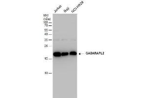 WB Image GABARAPL2 antibody detects GABARAPL2 protein by western blot analysis. (GABARAPL2 Antikörper  (Center))