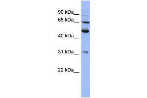 WB Suggested Anti-PSMD3  Antibody Titration: 0. (PSMD3 Antikörper  (N-Term))