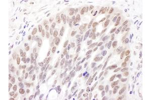 Immunohistochemistry (IHC) image for anti-DNA (Cytosine-5-)-Methyltransferase 3 alpha (DNMT3A) (AA 125-175) antibody (ABIN7454575)