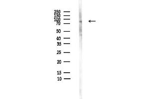 anti-Choline O-Acetyltransferase (CHAT) (C-Term) antibody