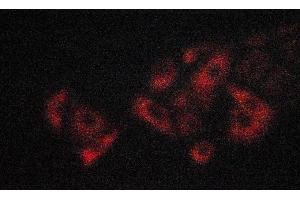 ABIN6274195 staining A549 cells by ICC/IF. (TNFRSF1B Antikörper  (C-Term))