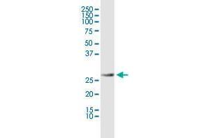 Western Blotting (WB) image for anti-Prohibitin (PHB) (AA 1-272) antibody (ABIN562206)