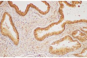 Immunohistochemistry of paraffin-embedded Human prostate gland using HRAS Polycloanl Antibody at dilution of 1:200 (HRAS Antikörper)
