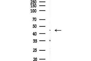 anti-Fucosyltransferase 6 (Alpha (1,3) Fucosyltransferase) (FUT6) (N-Term) antibody