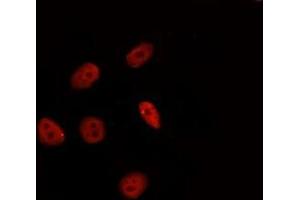 ABIN6277331 staining Hela by IF/ICC. (HSF2 Antikörper  (Internal Region))