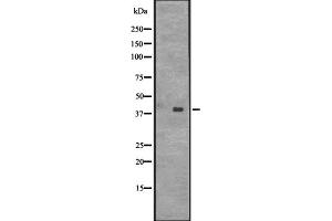 Western blot analysis of CENPL expression in HT1080 whole cell lysate ;,The lane on the left is treated with the antigen-specific peptide. (CENPL Antikörper  (Internal Region))