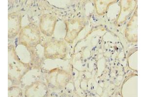 Immunohistochemistry of paraffin-embedded human kidney tissue using ABIN7173095 at dilution of 1:100 (TMEM174 Antikörper  (AA 94-243))
