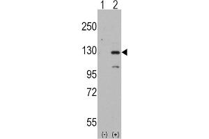 Western Blotting (WB) image for anti-Dishevelled Associated Activator of Morphogenesis 1 (DAAM1) antibody (ABIN3001578) (DAAM1 Antikörper)