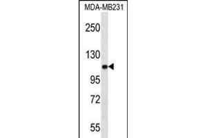 ACTN3 Antibody (Center) (ABIN656261 and ABIN2845575) western blot analysis in MDA-M cell line lysates (35 μg/lane).