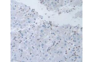 DAB staining on IHC-P; Samples: Human Liver Tissue (IL-19 Antikörper  (AA 25-177))